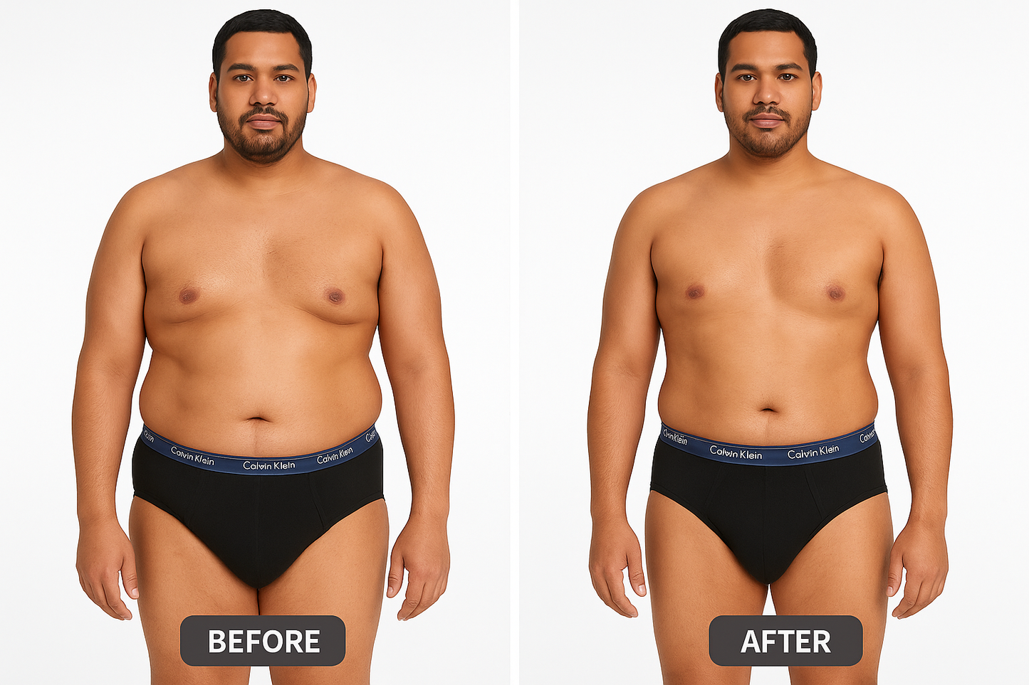 Imagen Comparativa - Antes y después